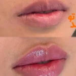 کلینیک زیبایی ظفر اندیشه