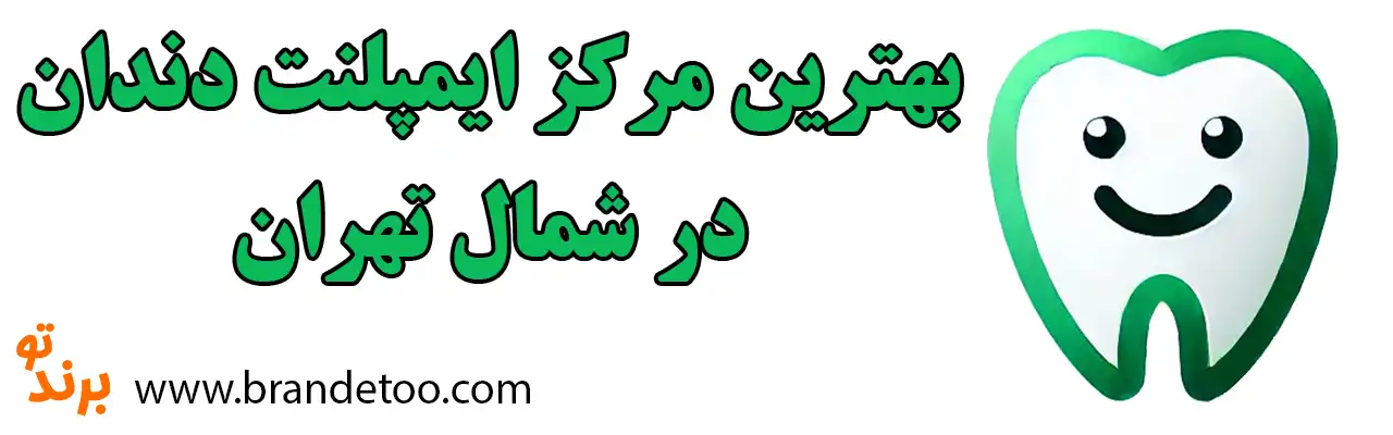 10-بهترین-ایمپلنت-دندان-شمال-تهران