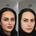 کلینیک زیبایی و لاغری بلو بیوتی رویال در پاسداران