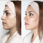 کلینیک زیبایی و لاغری بلو بیوتی رویال در پاسداران