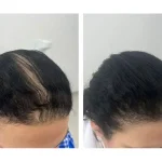 کلینیک زیبایی و لاغری بلو بیوتی رویال در پاسداران