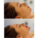 کلینیک زیبایی و لاغری بلو بیوتی رویال در پاسداران