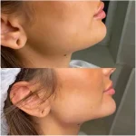 کلینیک زیبایی و لاغری بلو بیوتی رویال در پاسداران