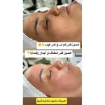 سالن زیبایی عطیه در چیتگر