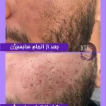 مراقبت زیبایی الهام کامرانی در یوسف آباد