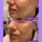 مراقبت زیبایی الهام کامرانی در یوسف آباد