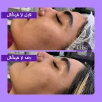 مراقبت زیبایی الهام کامرانی در یوسف آباد