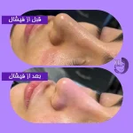 مراقبت زیبایی الهام کامرانی در یوسف آباد