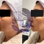 مراقبت زیبایی الهام کامرانی در یوسف آباد