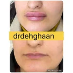 کلینیک زیبایی مانلی در فردیس