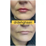 کلینیک زیبایی مانلی در فردیس