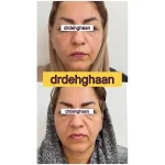کلینیک زیبایی مانلی در فردیس