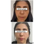 کلینیک زیبایی مانلی در فردیس