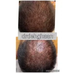 کلینیک زیبایی مانلی در فردیس