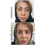 کلینیک زیبایی مانلی در فردیس