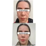 کلینیک زیبایی مانلی در فردیس