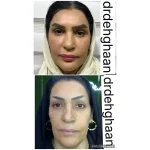 کلینیک زیبایی مانلی در فردیس