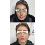 کلینیک زیبایی مانلی در فردیس
