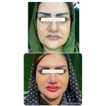 کلینیک زیبایی مانلی در فردیس