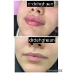 کلینیک زیبایی مانلی در فردیس