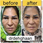 کلینیک زیبایی مانلی در فردیس