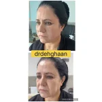 کلینیک زیبایی مانلی در فردیس