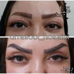 مطب دکتر سید رسول حسینی در اختیاریه