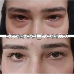 مطب دکتر سید رسول حسینی در اختیاریه