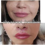 مطب دکتر سید رسول حسینی در اختیاریه