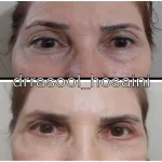 مطب دکتر سید رسول حسینی در اختیاریه
