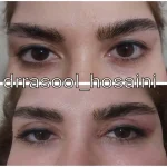مطب دکتر سید رسول حسینی در اختیاریه