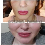 مطب دکتر سید رسول حسینی در اختیاریه