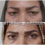 مطب دکتر سید رسول حسینی در اختیاریه