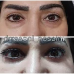مطب دکتر سید رسول حسینی در اختیاریه
