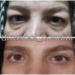 مطب دکتر سید رسول حسینی در اختیاریه