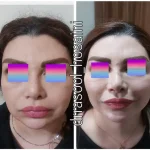 مطب دکتر سید رسول حسینی در اختیاریه
