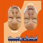کلینیک تخصصی فیشیال شهره در میرداماد