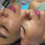 کلینیک تخصصی فیشیال شهره در میرداماد