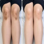 کلینیک تخصصی فیشیال شهره در میرداماد