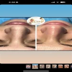 کلینیک تخصصی فیشیال شهره در میرداماد